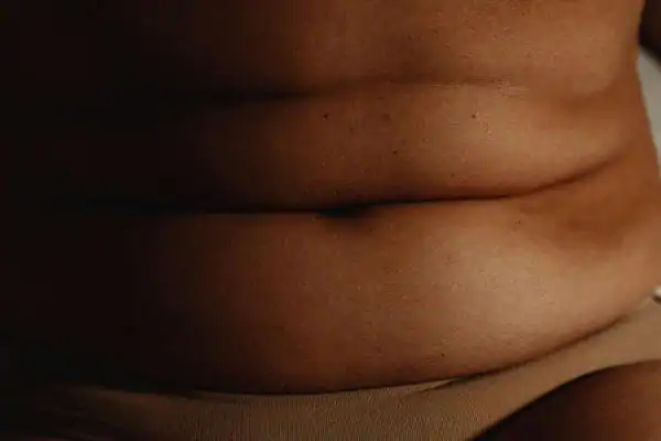 The Hidden Connection: How Stress Shapes Your Fitness and Body Composition 3 image of what stress can do on the stomach area and how Lipo 360 Wollaton can help to change your body shape.