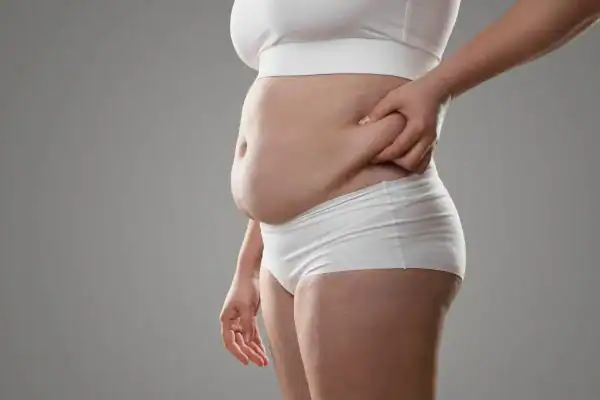 Image of stress belly Wollaton How Lipo 360 can help manage your symptoms